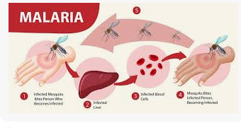 Anesthesia Management for Patient with  Malaria Infection